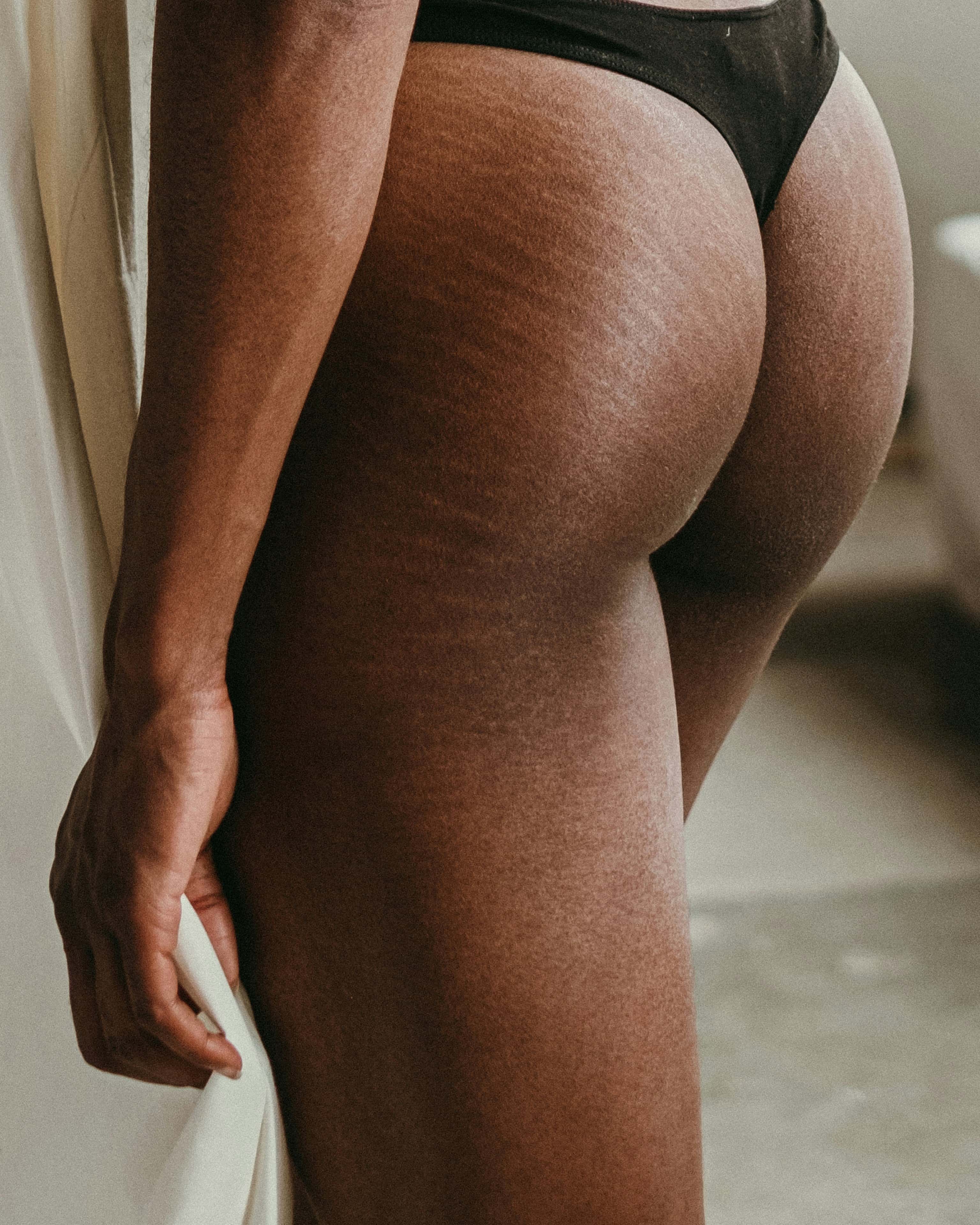 Terapeutkinja izvodi anti-cellulite masažu na butinama klijentkinje u modernom salonu u Beogradu